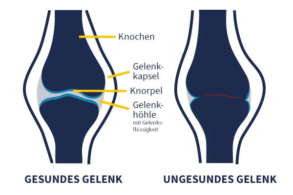 Arthrose und Arthritis beim Pferd richtig unterstützen